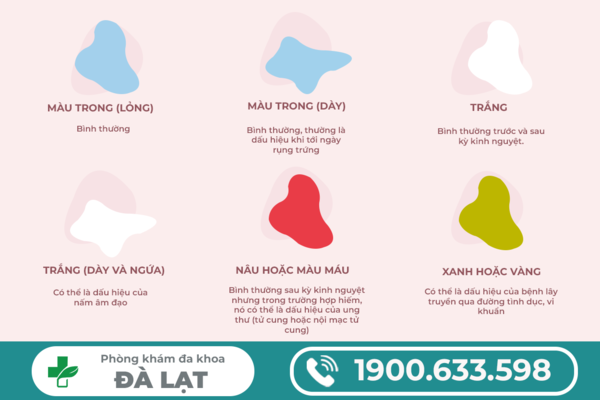 Hình ảnh minh họa